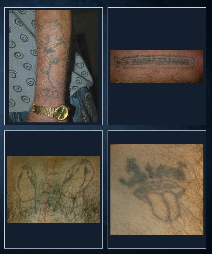 Een overzicht van de opvallende tatoeages op het lichaam van de ongeïdentificeerde man.